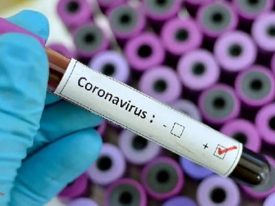 U Hrvatskoj dosad 713 osoba zaraženih koronavirusom, preminula šesta osoba 